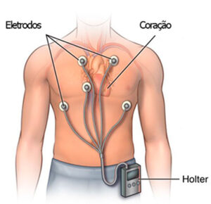 Lavoisier - Teste ergométrico, cintilografia miocárdica, ecocardiograma,  holter, mapa, eletrocardiograma, angiotomografia coronariana, escore de  cálcio e ressonância cardíaca. Aqui no Lavoisier Angélica I você encontra  diversos de exames cardiológicos